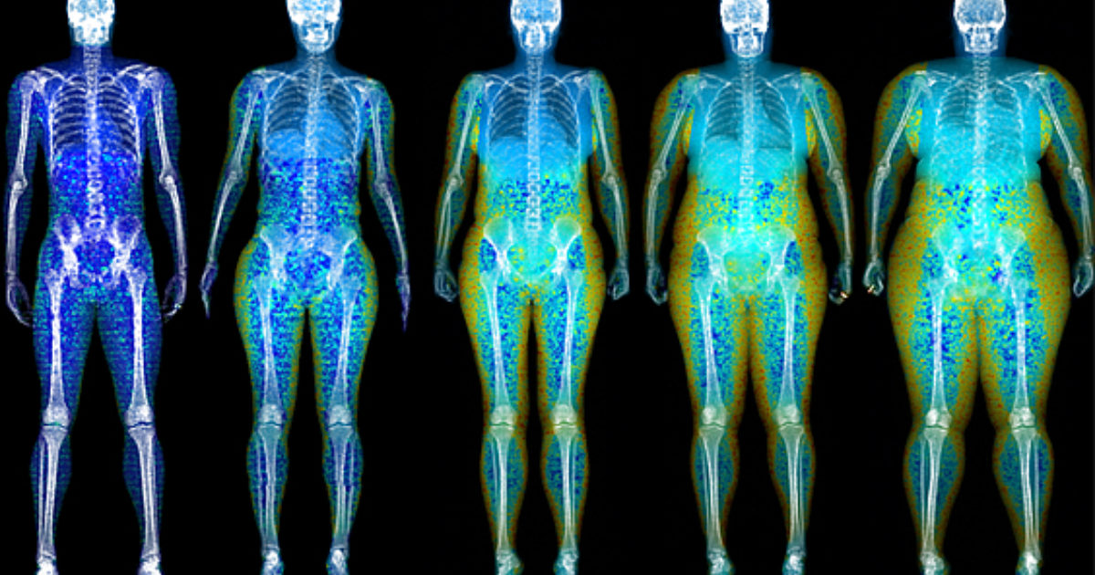 Body Composition Radiology